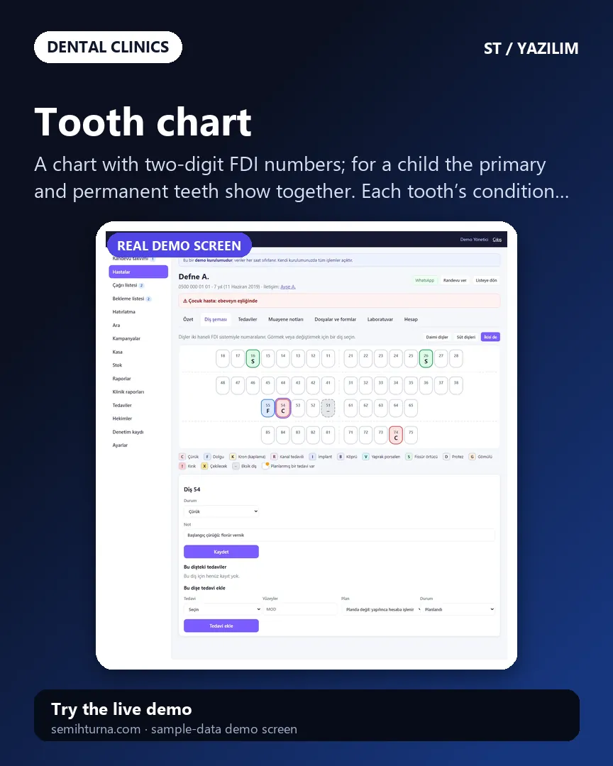 Dental Clinic Appointments and Patient Records, Tooth chart