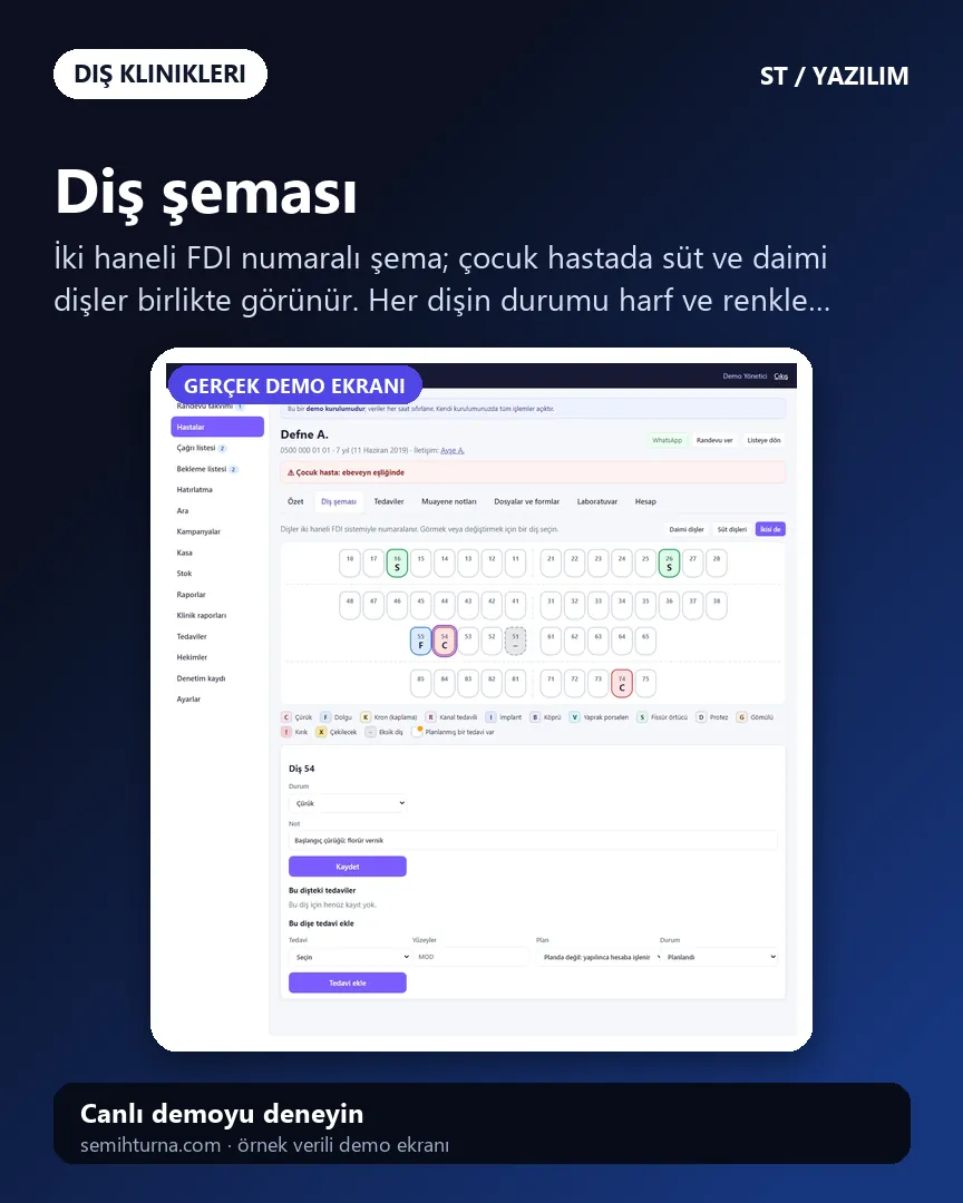Diş Kliniği Randevu ve Hasta Takibi, Diş şeması