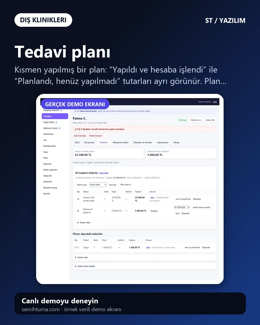 Diş Kliniği Randevu ve Hasta Takibi, Tedavi planı